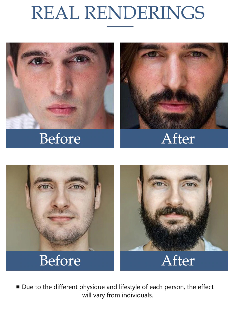 ESENCE PRO RŮST VLASŮ a VOUSŮ